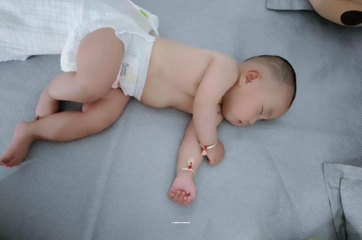 广州六个月宝宝眼睛散光